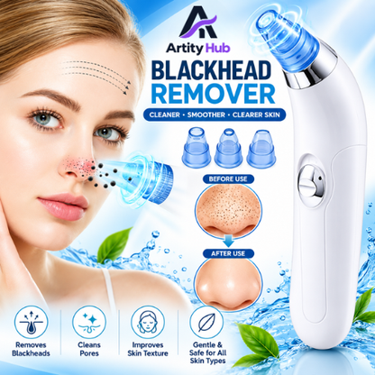 Derma Suction Blackheads Remover Device